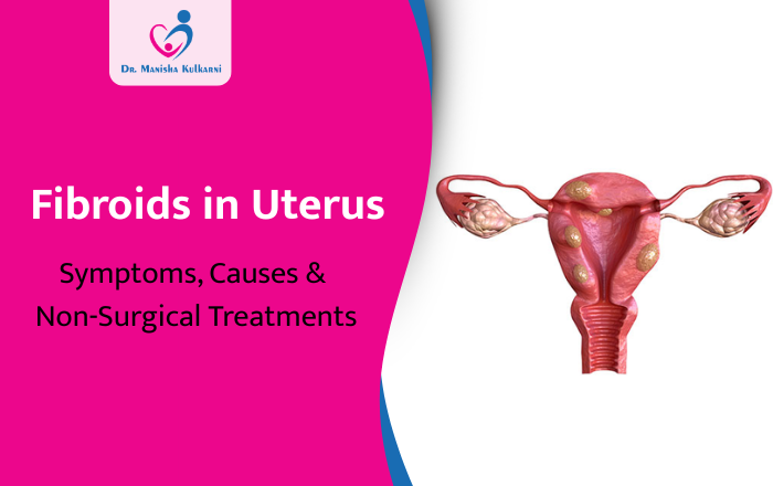 Fibroids in Uterus: Symptoms, Causes & Non-Surgical Treatments