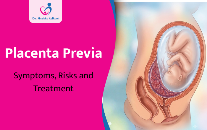 Placenta Previa: Symptoms, Risks and Treatment Guide
